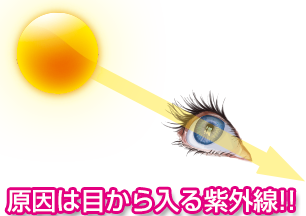 ́AĂ~߂ł͖hȂAڂ鎇OEUV